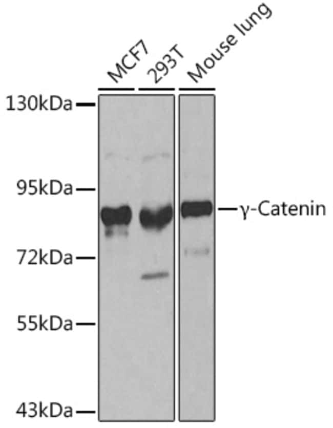 100UL GAMMA CATENIN ANTIBODY 100 ul