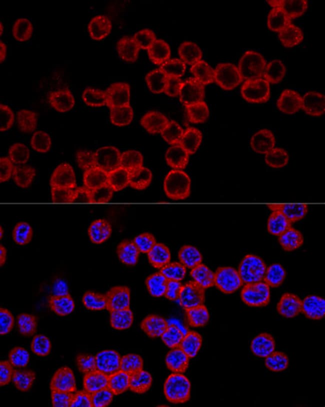 100UL CASPASE 1 ANTIBODY 100 ul