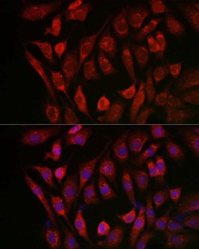 100UL CATHEPSIN B ANTIBODY 100 ul