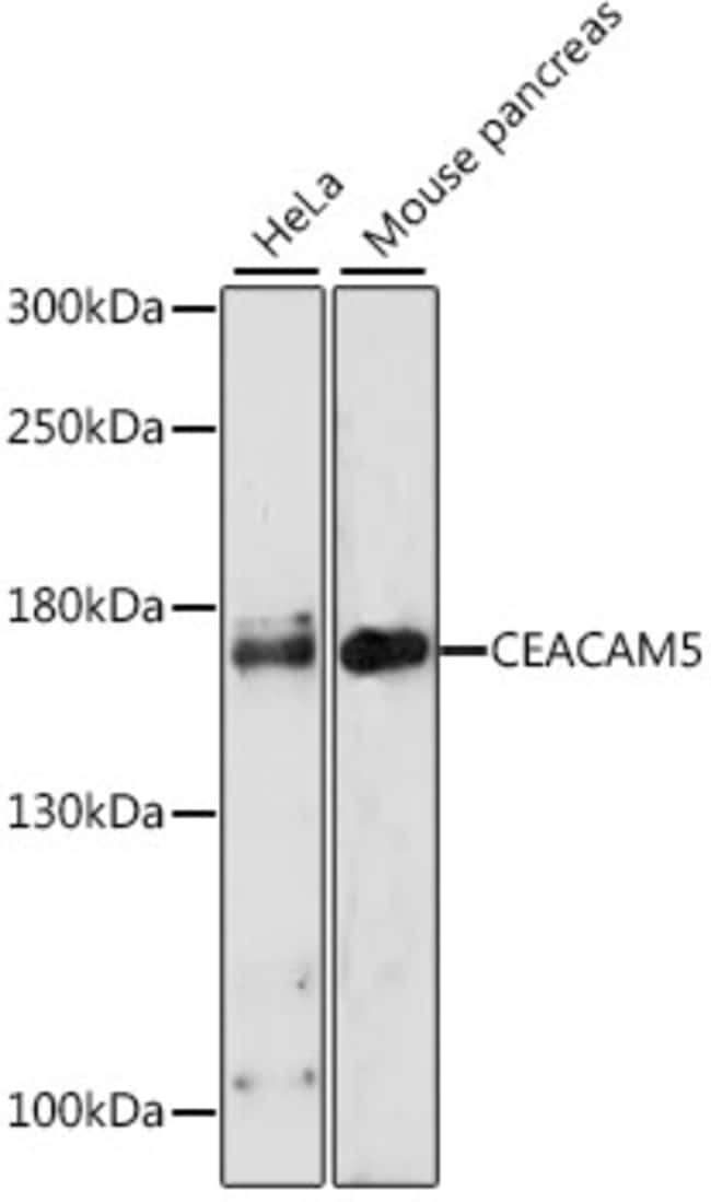 100UL CEACAM5 ANTIBODY 100 ul