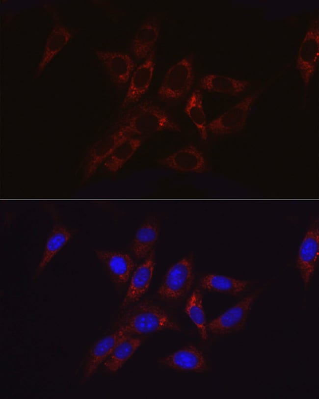 100UL HK2 ANTIBODY 100 ul
