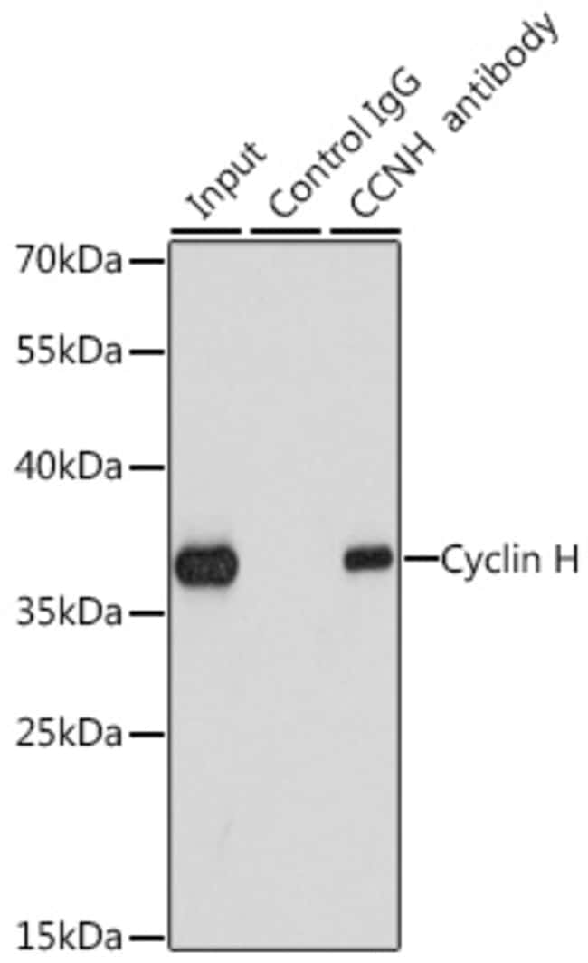 100UL CYCLIN H ANTIBODY 100 ul