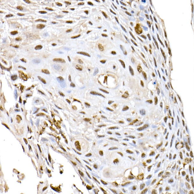 100UL ID2 ANTIBODY 100 ul