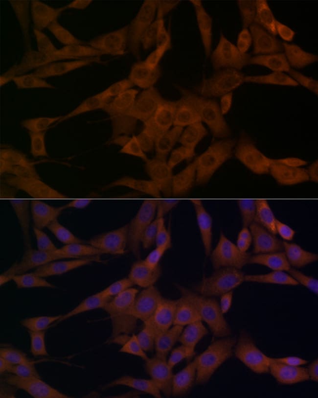 100UL BETA ARRESTIN 1 ANTIBODY 100 ul