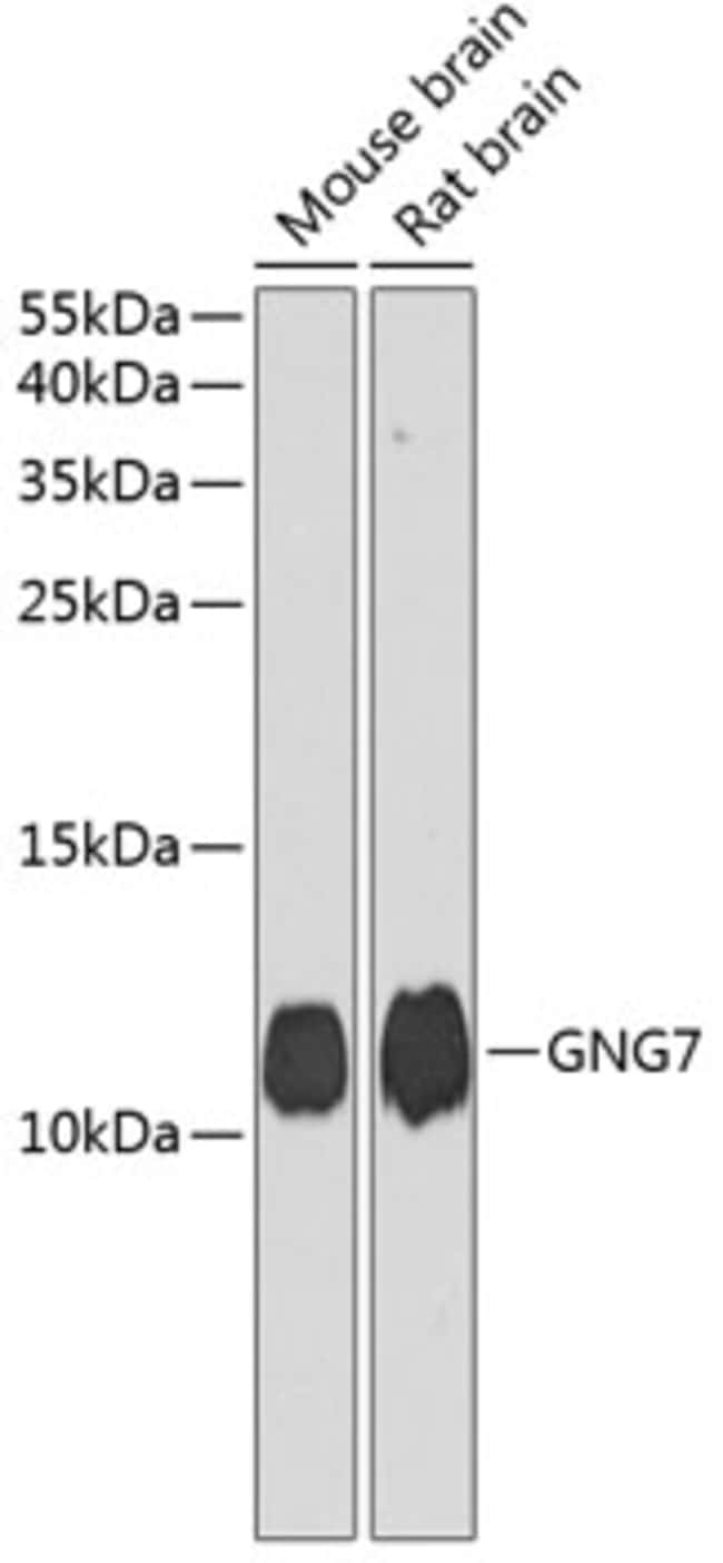 100UL GNG7 ANTIBODY 100 ul