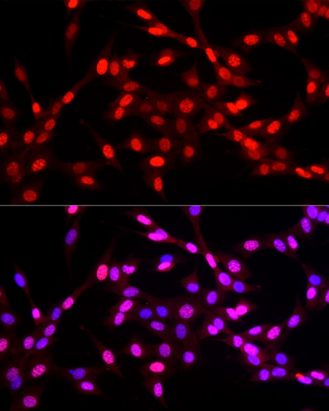 100UL KLF6 ANTIBODY 100 ul