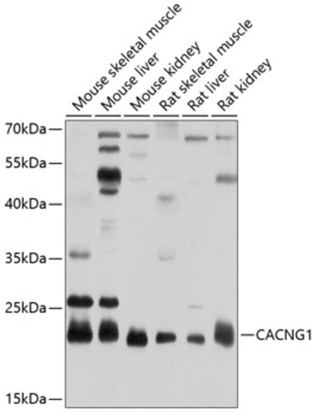 100UL CACNG1 ANTIBODY 100 ul