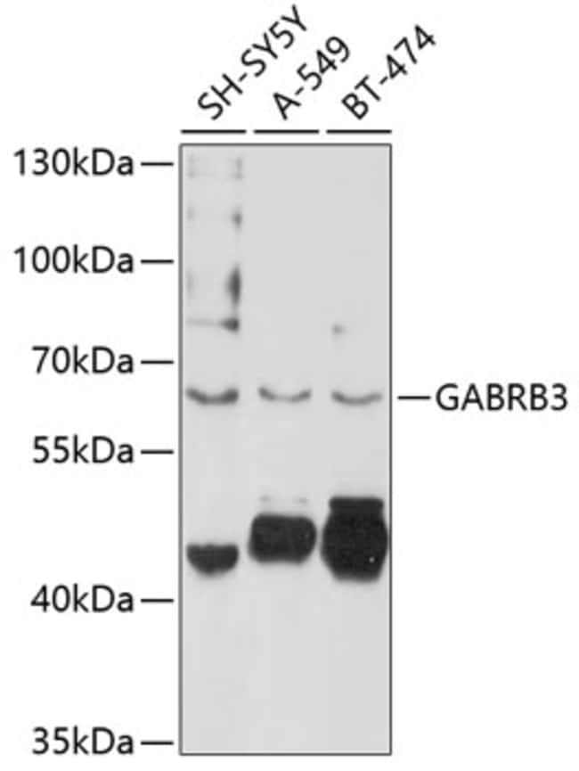 100UL GABRB3 ANTIBODY 100 ul