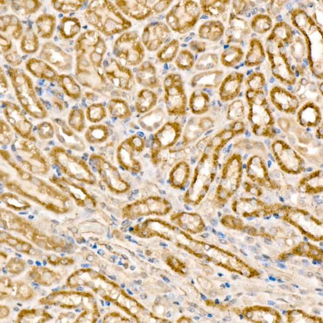 100UL MCCC1 ANTIBODY 100 ul
