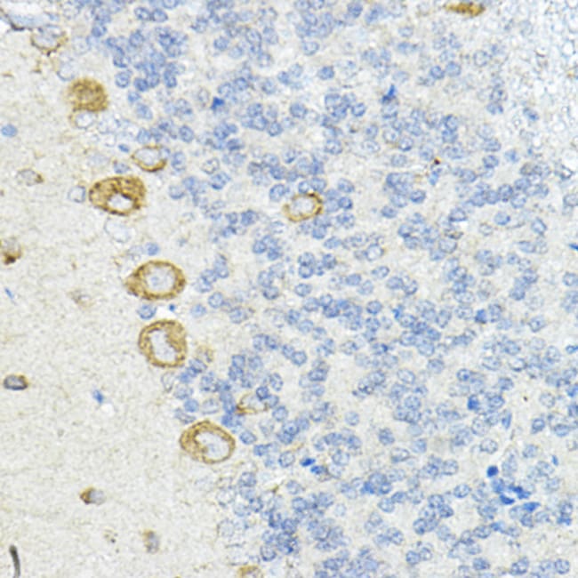 100UL LRRC59 ANTIBODY 100 ul