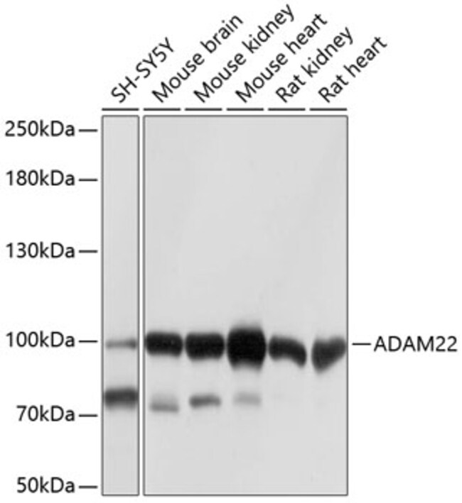 100UL ADAM22 ANTIBODY 100 ul