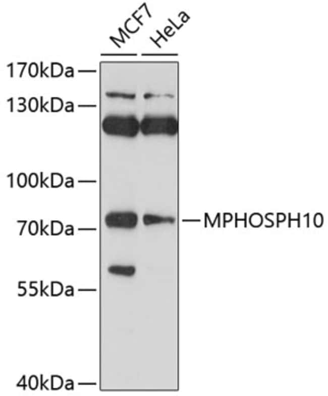 100UL MPP10 ANTIBODY 100 ul