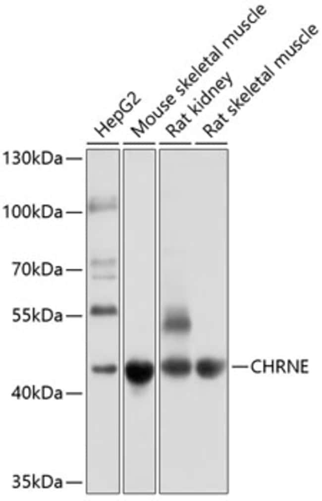100UL CHRNE ANTIBODY 100 ul