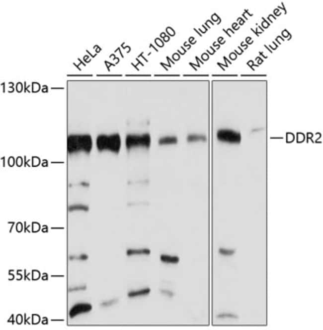 100UL DDR2 ANTIBODY 100 ul
