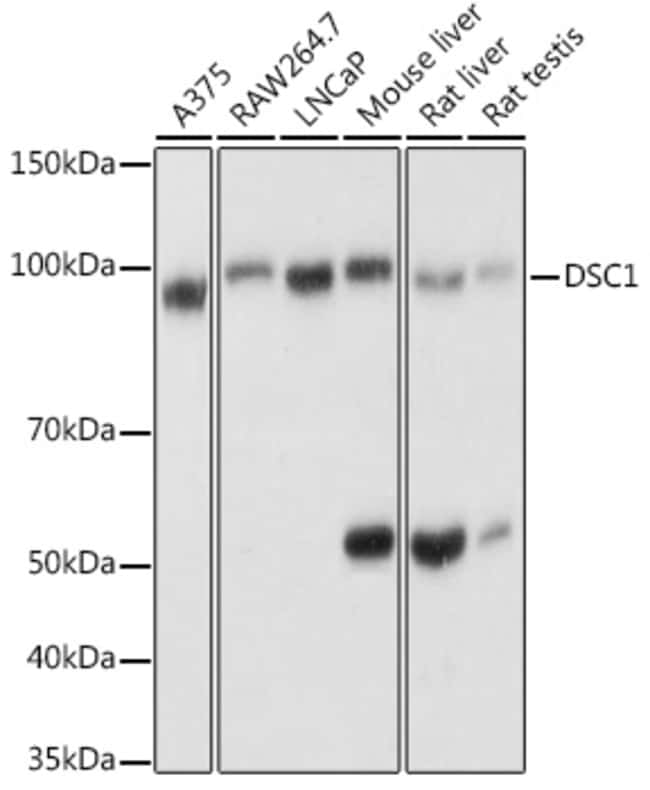 100UL DSC1 ANTIBODY 100 ul