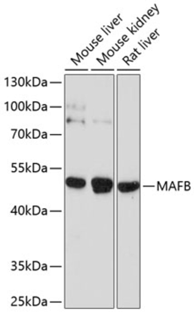 100UL MAFB ANTIBODY 100 ul