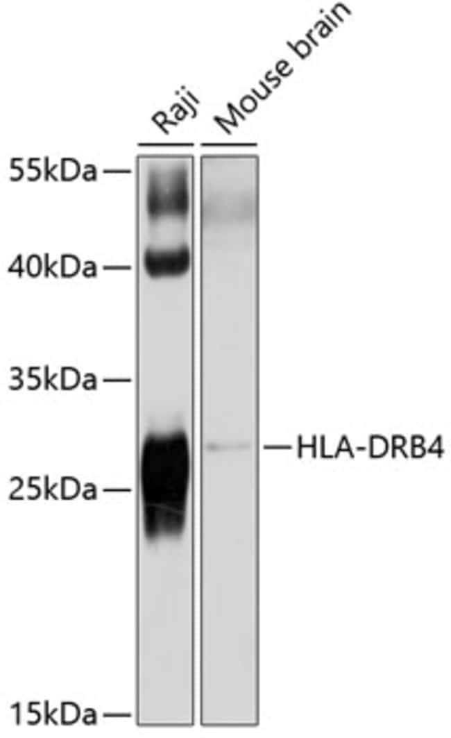 100UL HLA-DRB4 ANTIBODY 100 ul