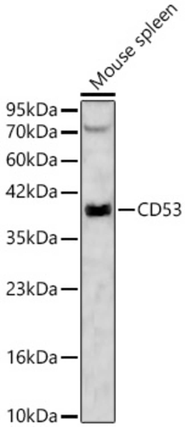 100UL CD53 ANTIBODY 100 ul