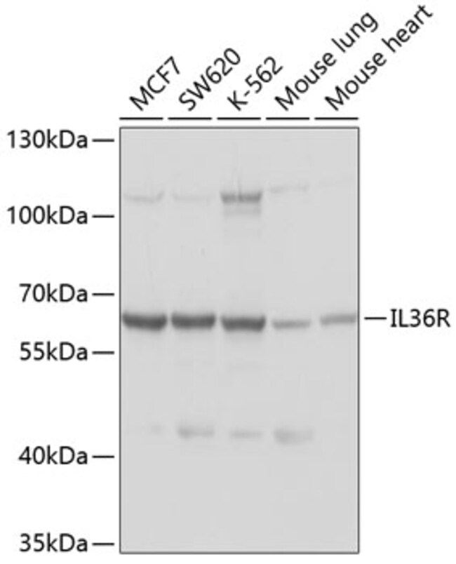 100UL IL1RL2 ANTIBODY 100 ul