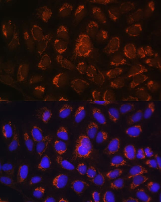 100UL ART1 ANTIBODY 100 ul