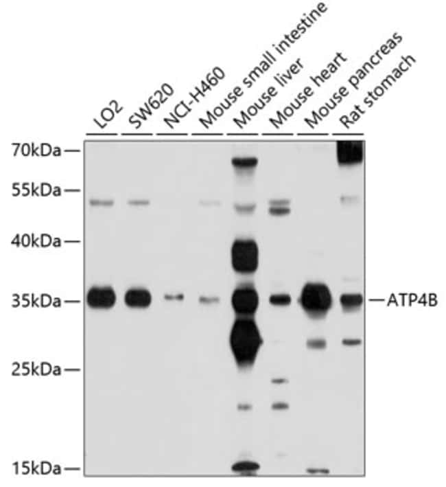 100UL ATP4B ANTIBODY 100 ul