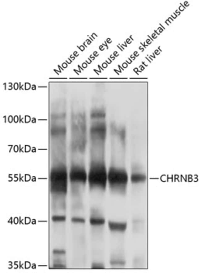 100UL CHRNB3 ANTIBODY 100 ul