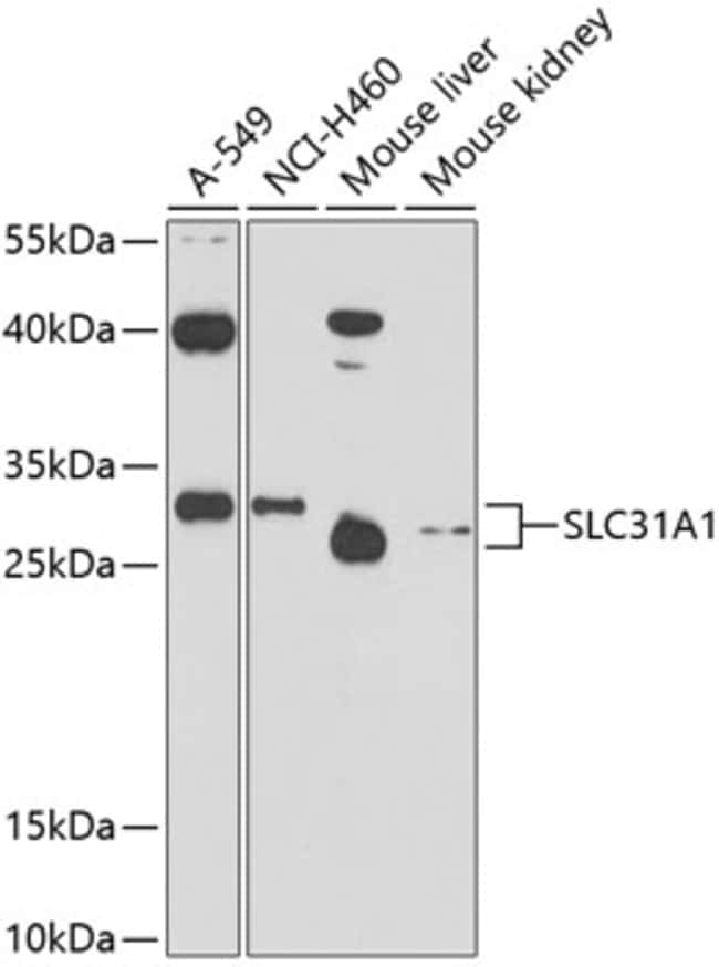 100UL CTR1 ANTIBODY 100 ul