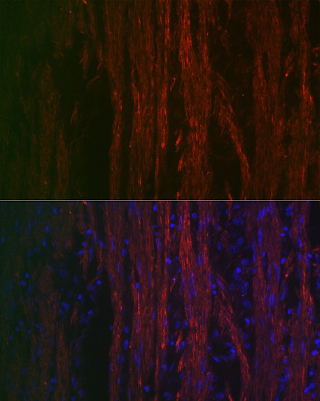 100UL ALPHA-SMOOTH MUSCLE ACTIN ANTI 100