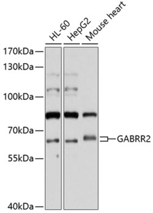 100UL GABRR2 ANTIBODY 100 ul