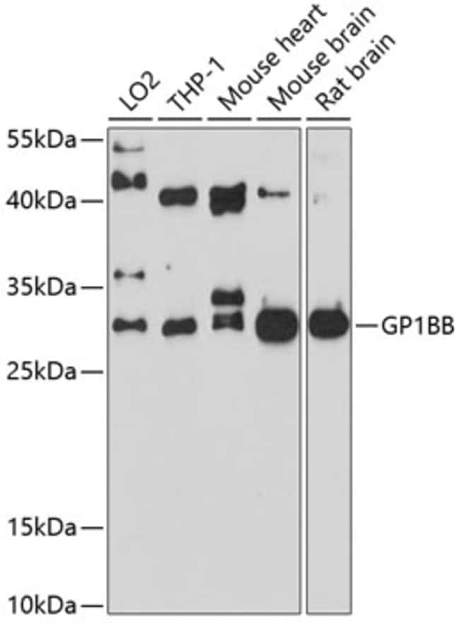 100UL GP1BB ANTIBODY 100 ul
