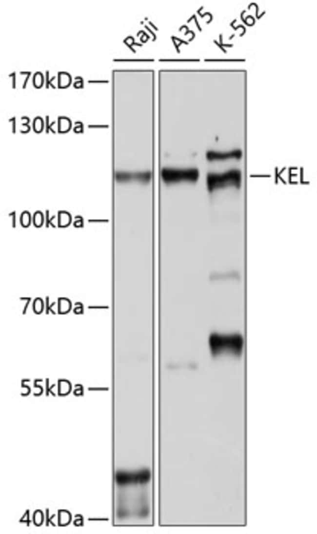 100UL KELL ANTIBODY 100 ul