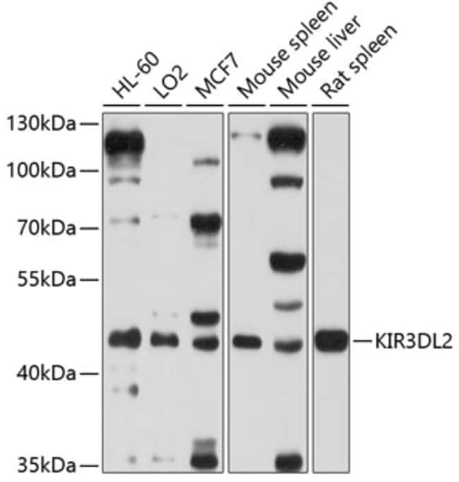 100UL KIR3DL2 ANTIBODY 100 ul