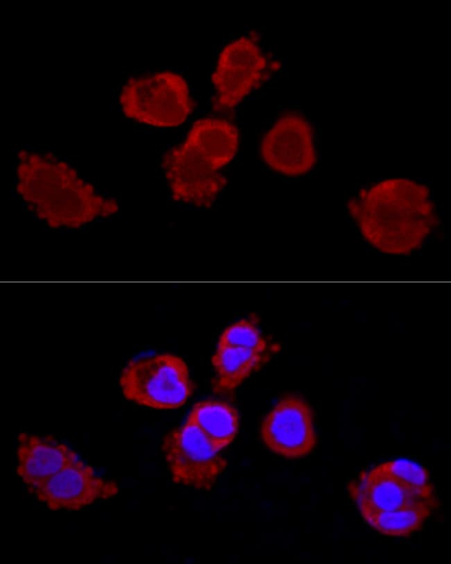 100UL CYTOKERATIN 3 ANTIBODY 100 ul