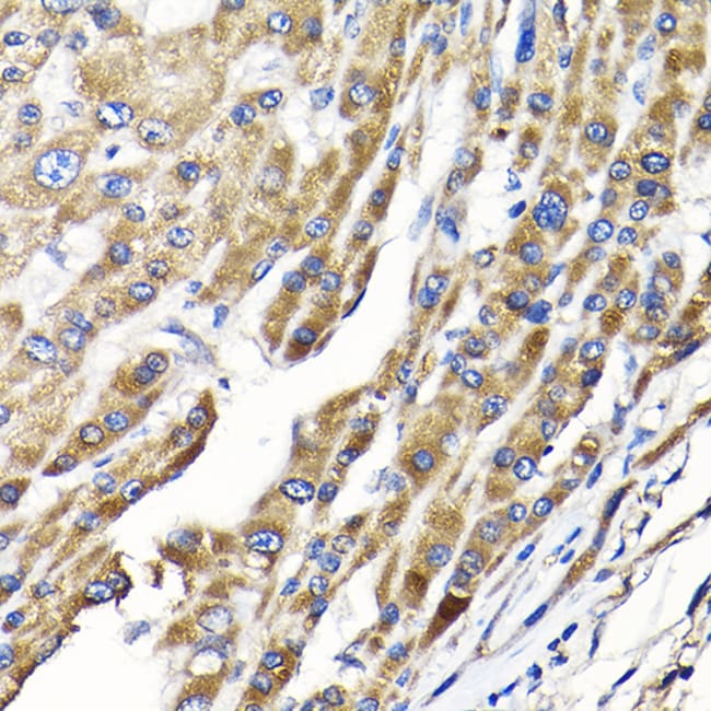 100UL IKAP ANTIBODY 100 ul