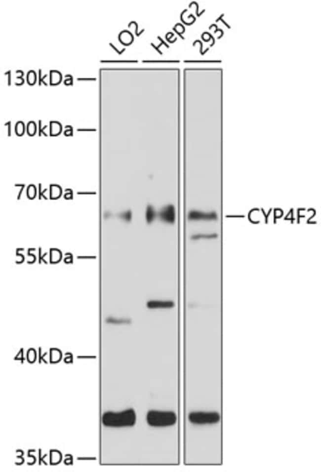 100UL CYP4F2 ANTIBODY 100 ul