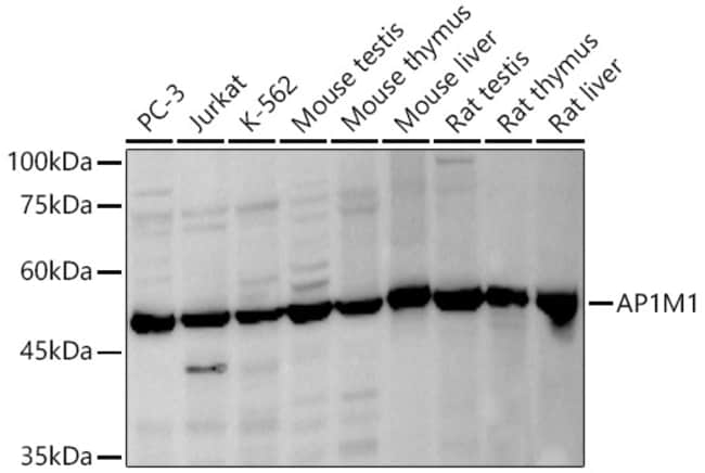 100UL AP1M1 ANTIBODY 100 ul