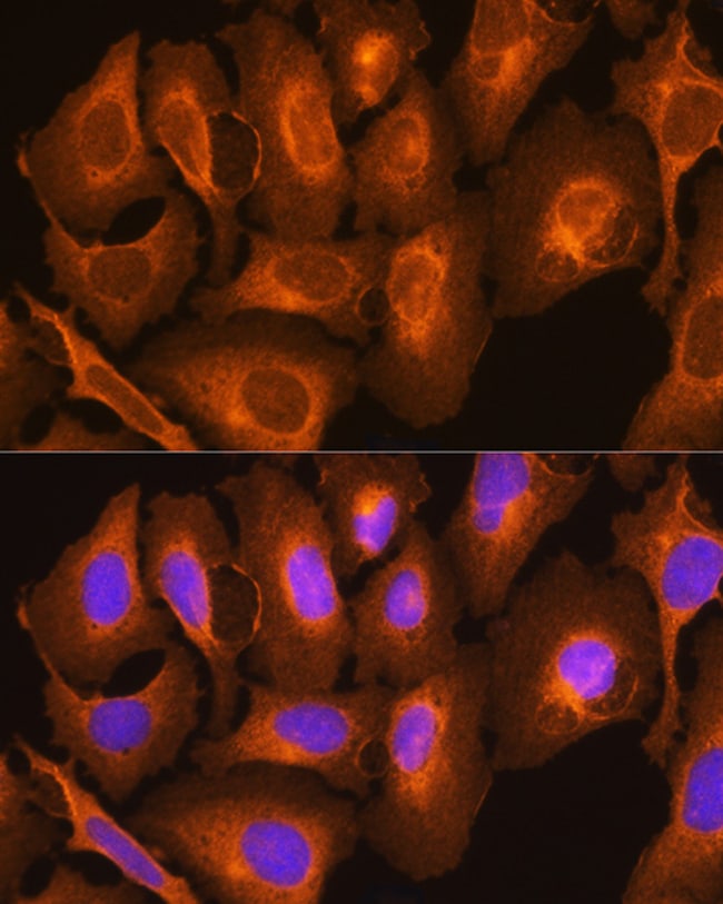 100UL HLA-C ANTIBODY 100 ul