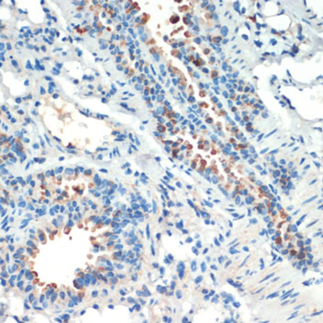 100UL MSK2 ANTIBODY 100 ul