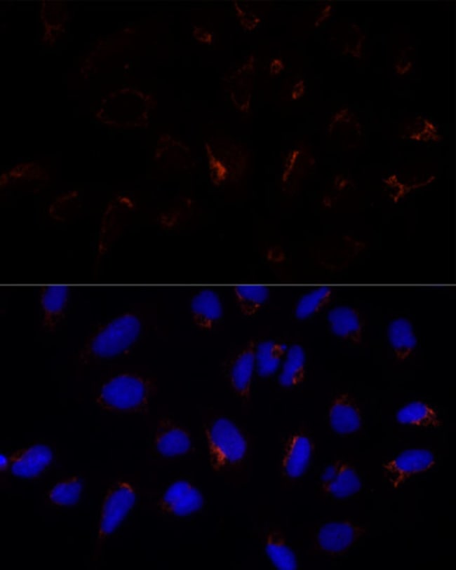 100UL ETHE1 ANTIBODY 100 ul