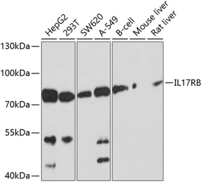 100UL IL17RB ANTIBODY 100 ul