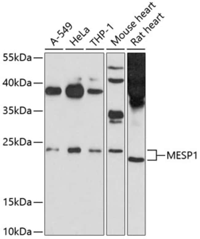 100UL MESP1 ANTIBODY 100 ul