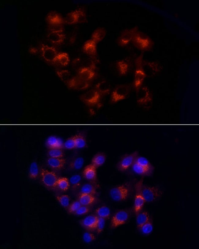 100UL ALPHA-1 ANTITRYPSIN ANTIBODY 100 u