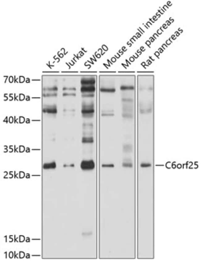100UL G6B ANTIBODY 100 ul