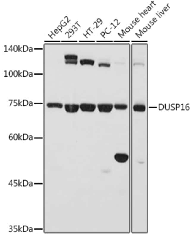 100UL DUSP16 ANTIBODY 100 ul