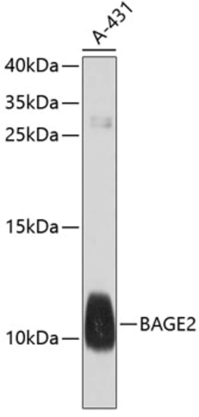 100UL BAGE2 ANTIBODY 100 ul