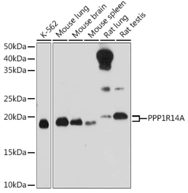 100UL CPI-17 ANTIBODY 100 ul