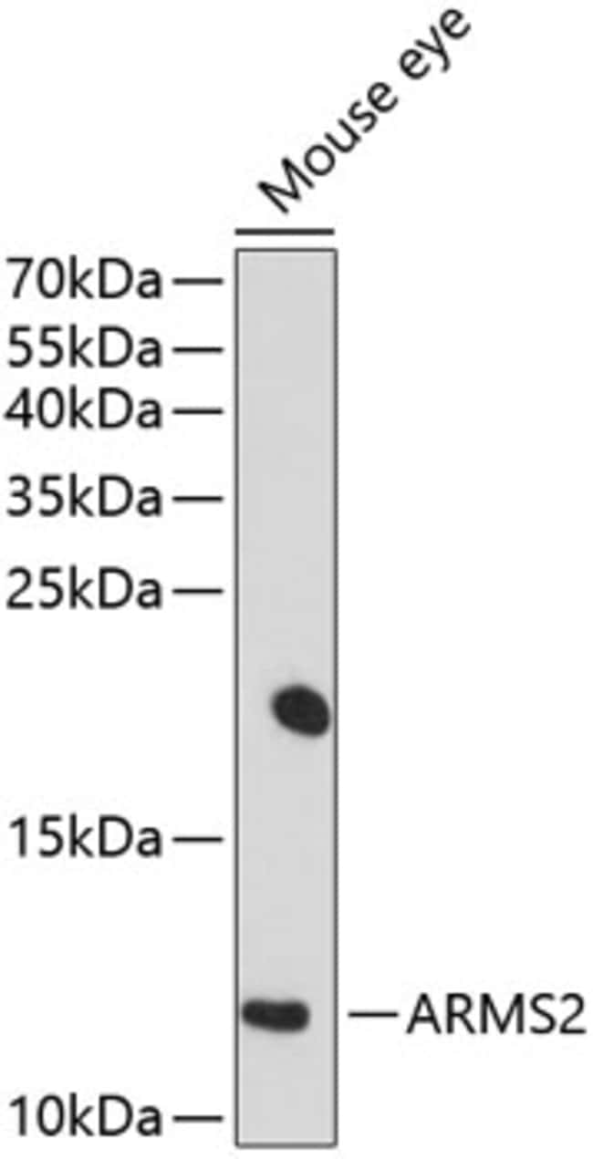 100UL ARMS2 ANTIBODY 100 ul