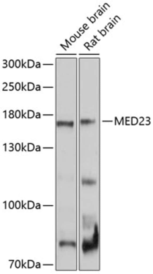 100UL CRSP130 ANTIBODY 100 ul