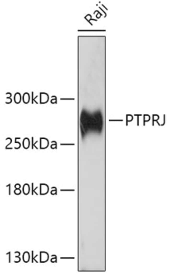 100UL HIS6-DEP-1 ANTIBODY 100 ul