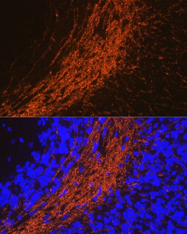 100UL CNP ANTIBODY 100 ul